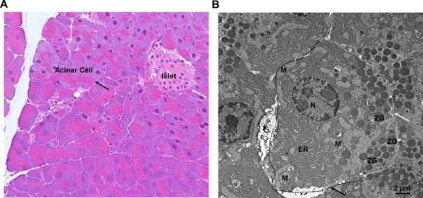 Autophagy in pancreatitis