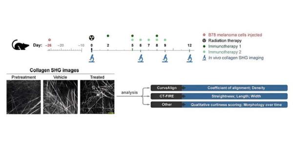 New biomarkers of respo<em></em>nse in melanoma immunotherapy