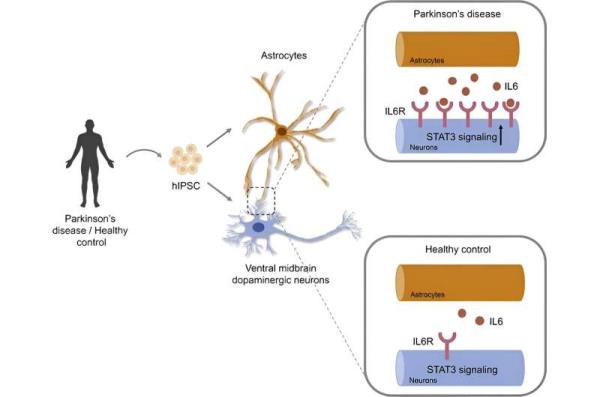 Researchers identify immunomodulatory drug as a potential treatment for Parkinson’s disease