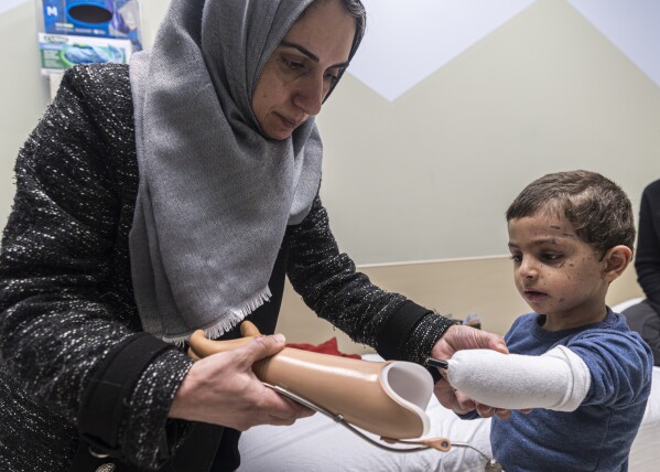 Orthopedic surgeon Dr. Scott Kozin, right, holds the arm of 4-year-old Omar Abu Kuwaik for an x-ray while Omar's aunt Maha Abu Kuwaik holds his hand at Shriners Children's Hospital, Thursday, Jan. 18, 2024, in Philadelphia. (AP Photo/Peter K. Afriyie)