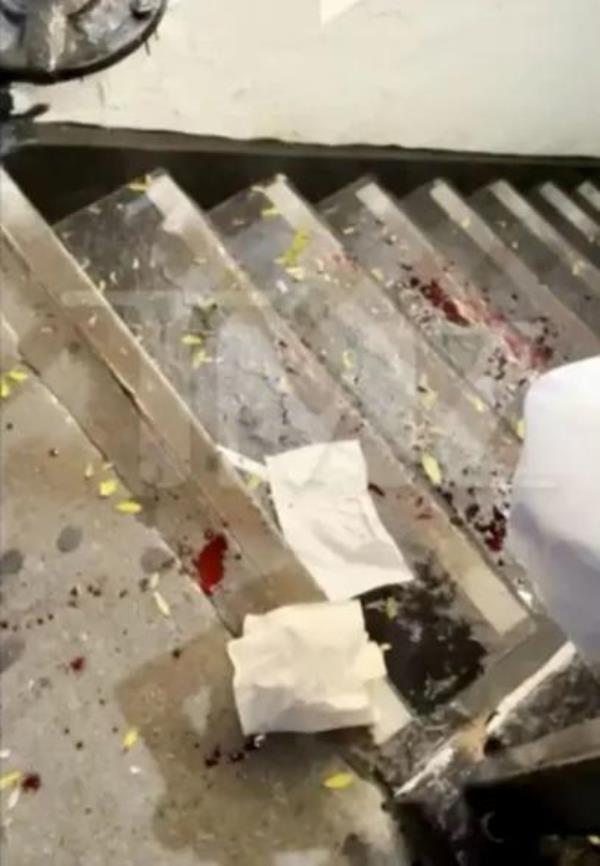 Blood on a staircase after Chris Redd's attack