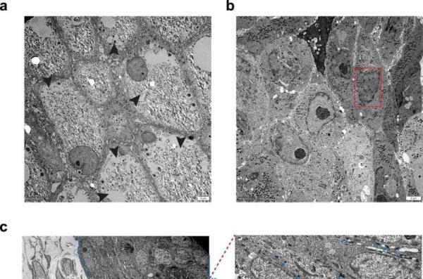 Lab-grown skin helps unlock secrets of mpox virus infection