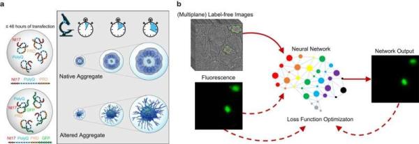 AI unlocks new insights in neurodegenerative disease research