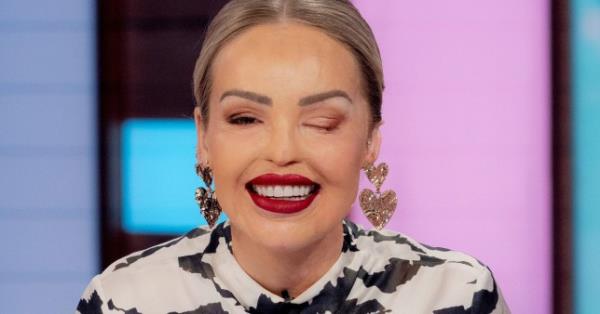 Katie Piper on Loose Women