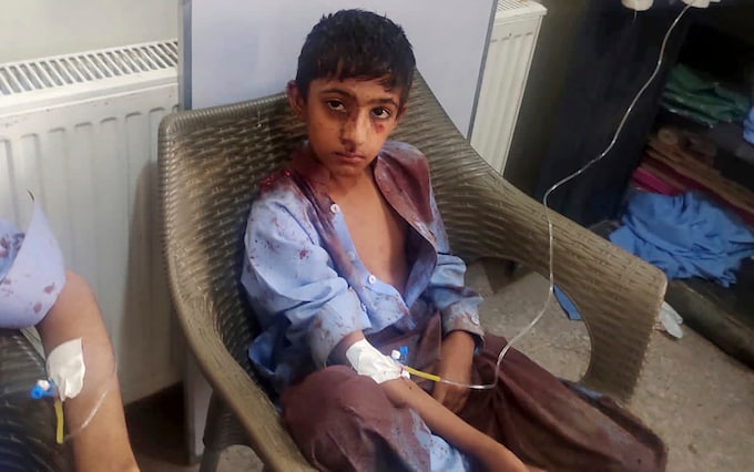 A boy injured in the bomb explosion