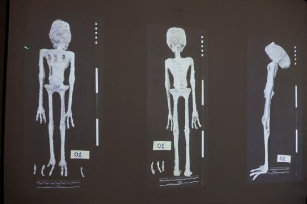 An X-rays and study carried out by the Institute of Legal Medicine of Peru on the 'alien mummies' that co<em></em>ncluded that they are dolls made with animal bo<em></em>nes is displayed in Lima, Peru, January 12, 2024. 