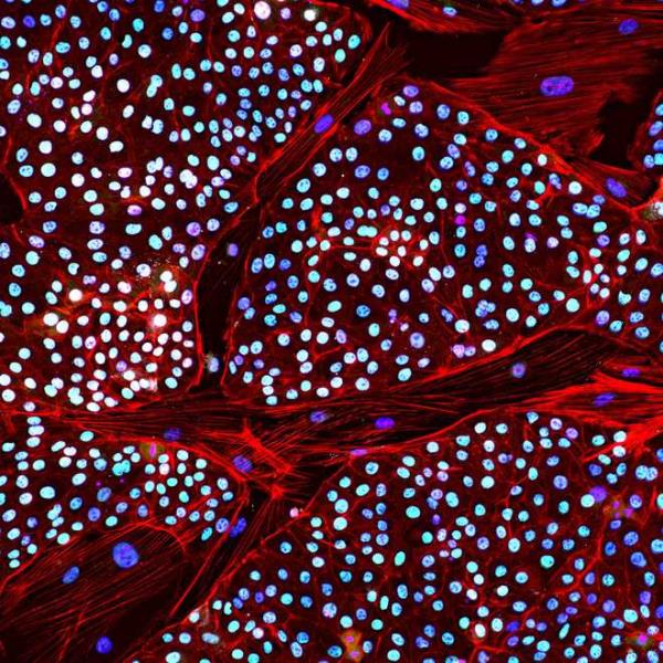 Pictured is an Asian elephant stem cell line stained in different colors to highlight different elements.