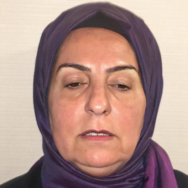 Turkey: Before and after photos of woman after plastic surgery spark co<em></em>ntroversy if it is her https://www.instagram.com/p/CxBLwYhqr84/?img_index=10