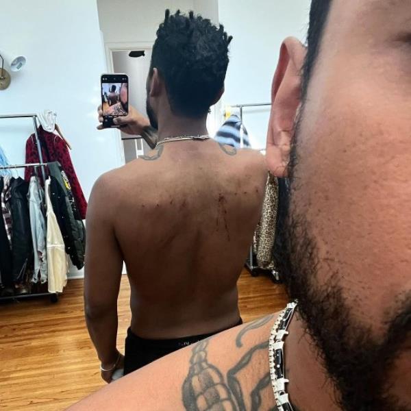 Miguel shows bloodied and pierced skin in selfie