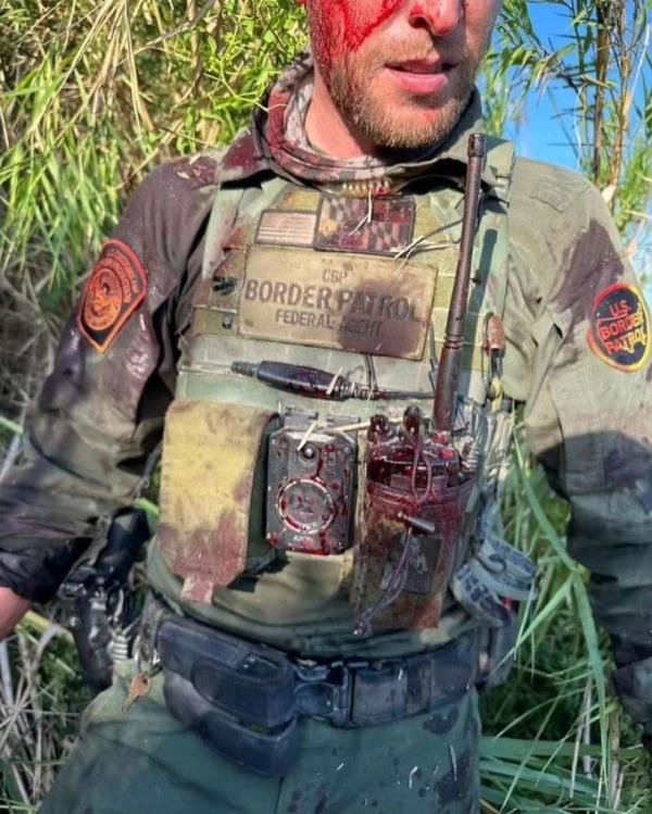 Bloodied Border Patrol agent