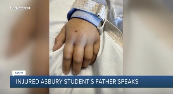 The young university student also noticed her acrylic nails had been ripped off when she woke up in the hospital.