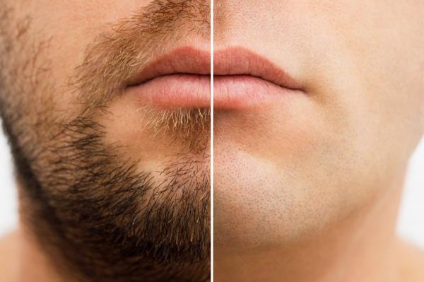 Close up photo of a man's face before and after shavin<em></em>g. a young man with a beard.